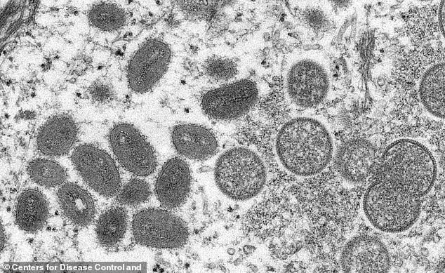 The virus is transmitted from one person to another by close contact with lesions, body fluids, respiratory droplets and contaminated materials such as bedding - and may be sexually transmitted (pictured, a 2003 electron microscope image showing monkeypox